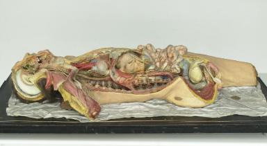 Jean Martin Gustave Tramond, Wachsmodell eines Körpers