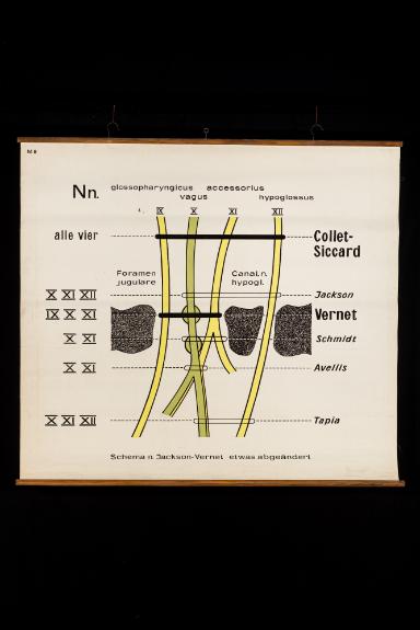 Der schematische Verlauf der kaudalen Hirnnerven (IX–XII) am Austritt aus der Schädelbasis (IX–XII)