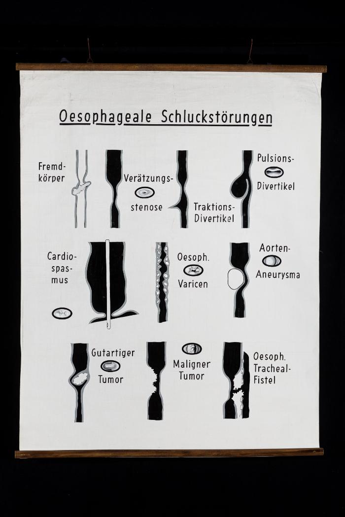 Oesophageale Schluckstörungen