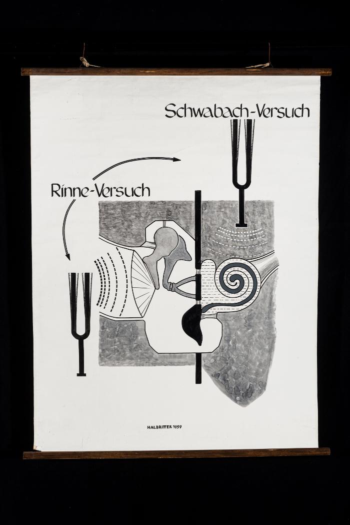 Schwabach-Versuch und Rinne-Versuch