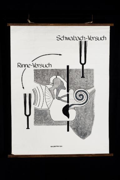 Schwabach-Versuch und Rinne-Versuch