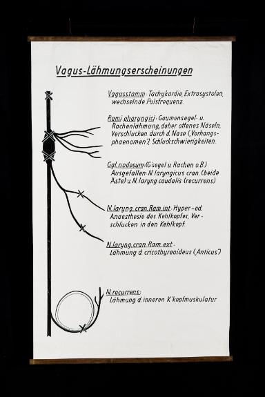 Vagus-Lähmungserscheinungen