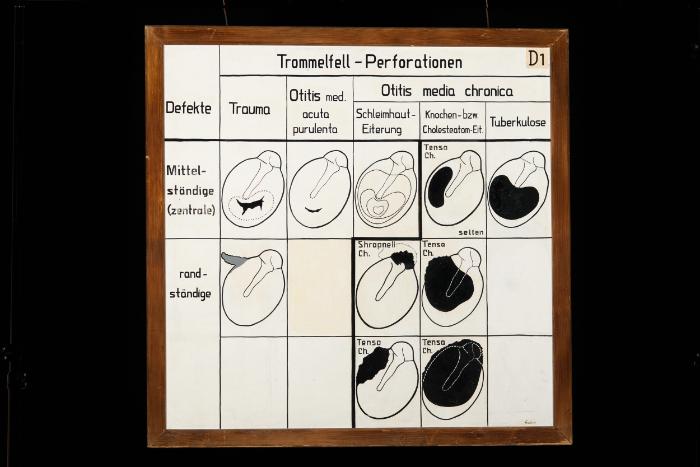 Trommelfell-Perforationen