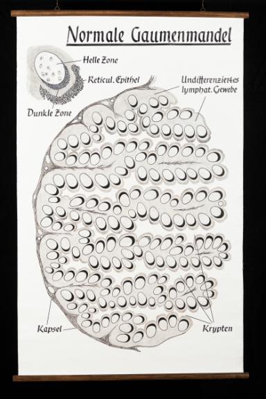 Schematische histologische Darstellung der normalen Gaumenmandel (Tonsilla palatina)