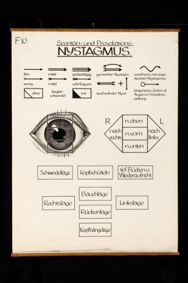 Spontan- und Provokations-Nystagmus