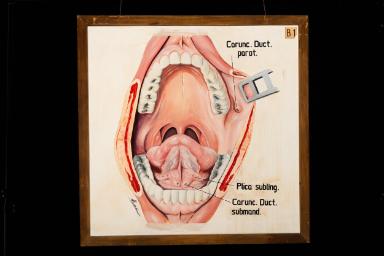 Image representation for Sammlung der HNO-Klinik