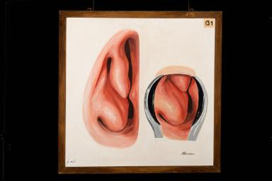 Unterer und mittlerer Nasengang der rechten Nasenhaupthöhle und 
vordere Naseninspektion mit dem Nasenspekulum