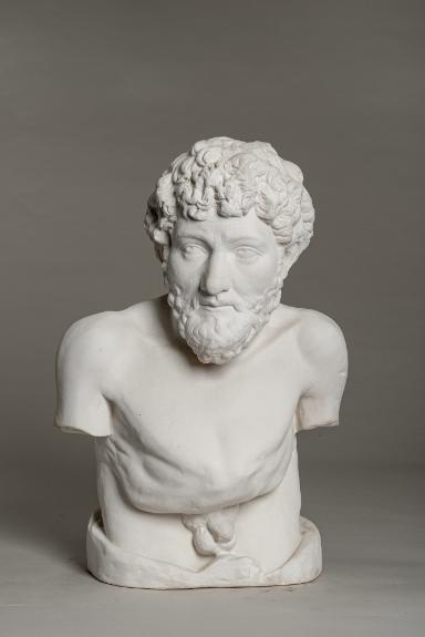 Torso der Porträtstatue eines verwachsenen Mannes, sog. Äsop