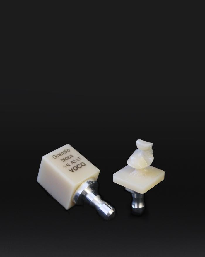 CAD/CAM-Keramikrestauration