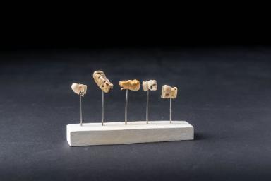 Schaumodell mit fünf Zahnporthesen